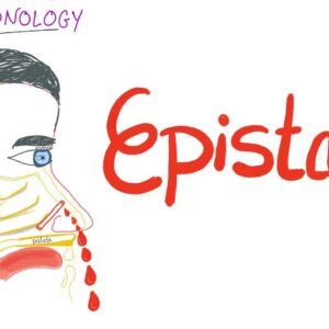 Epistaxis (nosebleed); Causes and Management