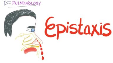 Epistaxis (nosebleed); Causes and Management