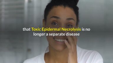 Toxic Epidermal Nephrolysis Symptoms