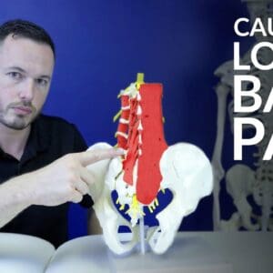 Low back pain- The most common causes of lower back pain