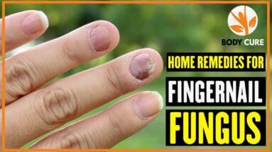 5 Home Remedies For Fingernail Fungus - Body Cure