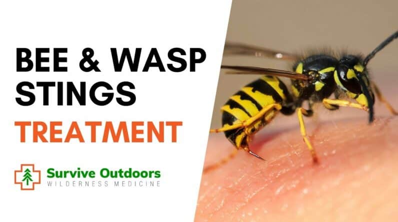 How to Treat Bee and Wasp Stings