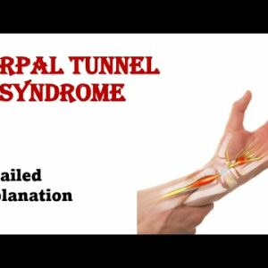 Carpal tunnel syndrome | Anatomy | cause | symtoms | examinatiom | test | Treatment | short note.