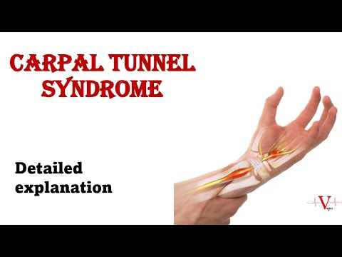 What Is The Cause For Carpal Tunnel Syndrome