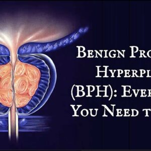 Benign Prostatic Hyperplasia (BPH): Everything You Need To Know
